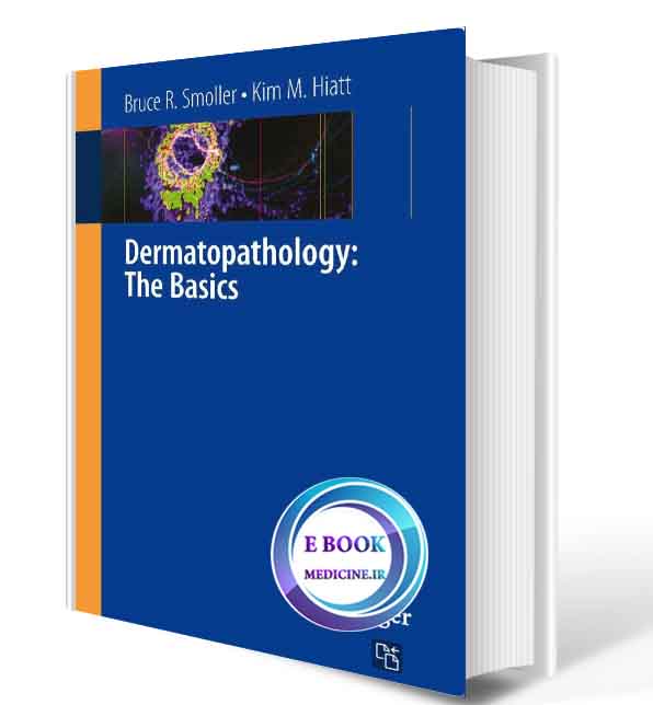 دانلود کتاب Dermatopathology: The Basics(ORIGINAL PDF)